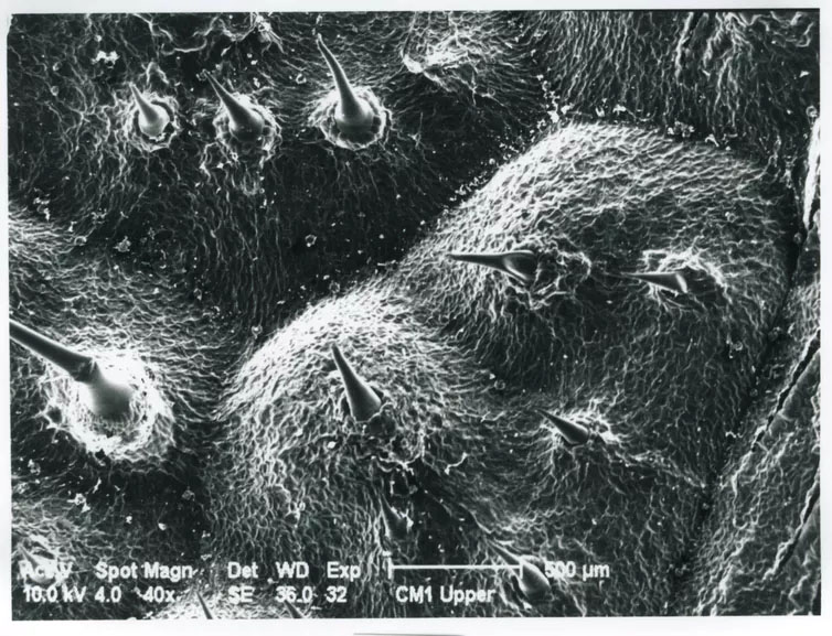 gympie gympie stinging tree micrograph