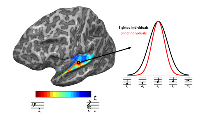 017 MRI study confirms the audition to the blind 1