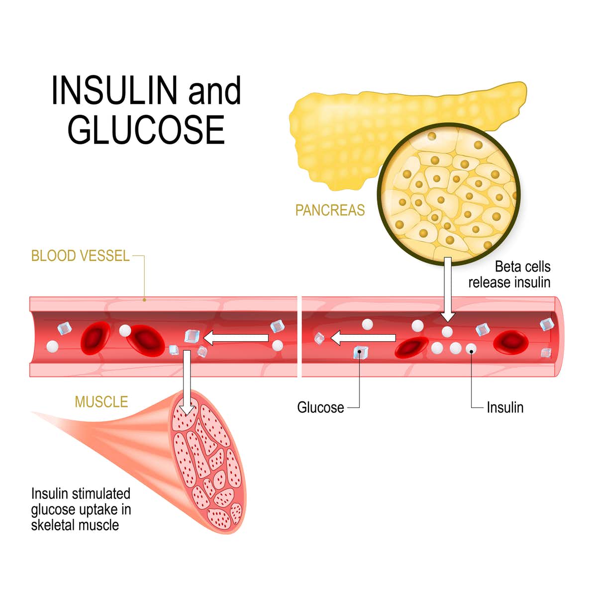 Beta-cells in the pancreas release insulin in the blood vessel. Insulin stimulates the absorption of glucose in skeletal muscle. (Designua/Shutterstock)