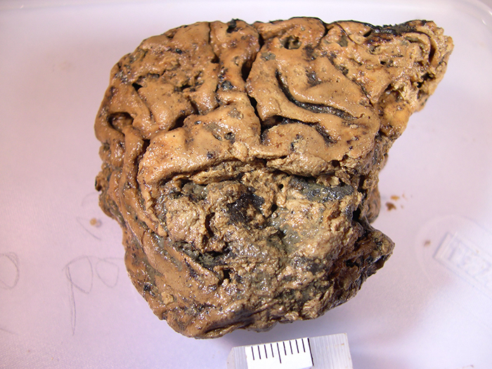 Muestra de cerebro de Heslington