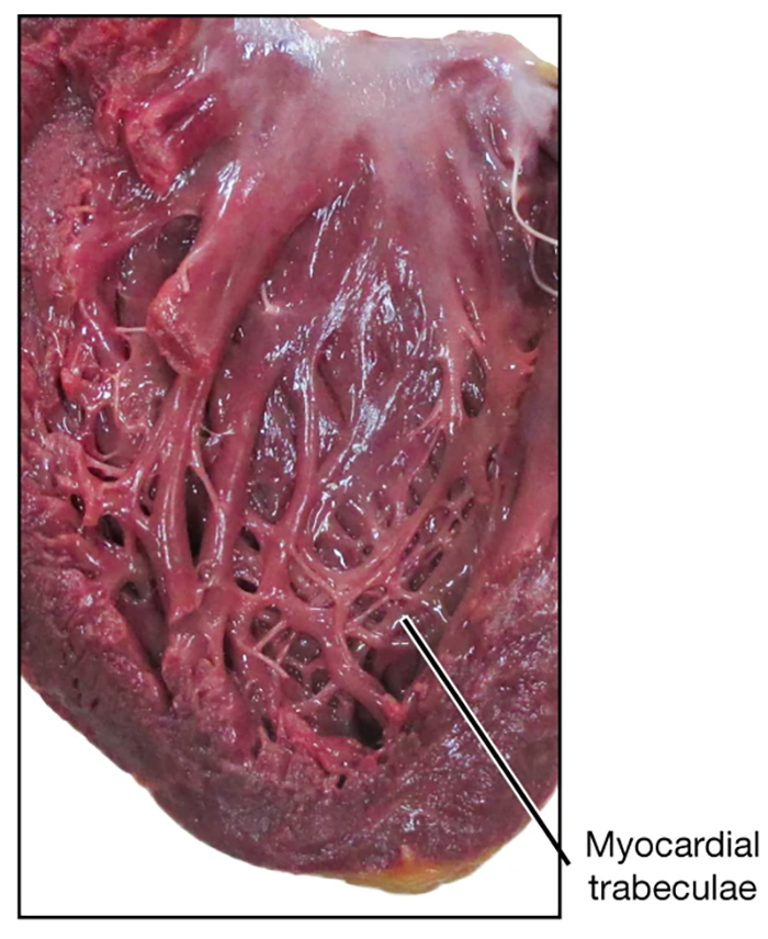 myocardial trabeculae