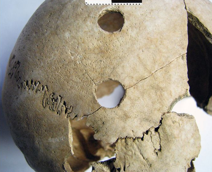 Skull from Potocani grave showing injury