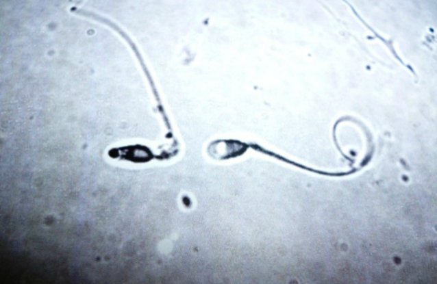 Spermweb_1024.jpg