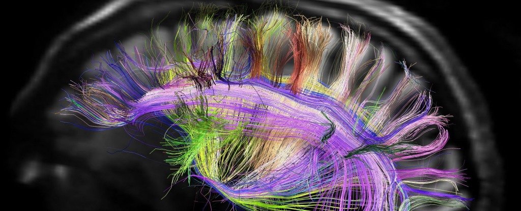  Human Connectome Project 