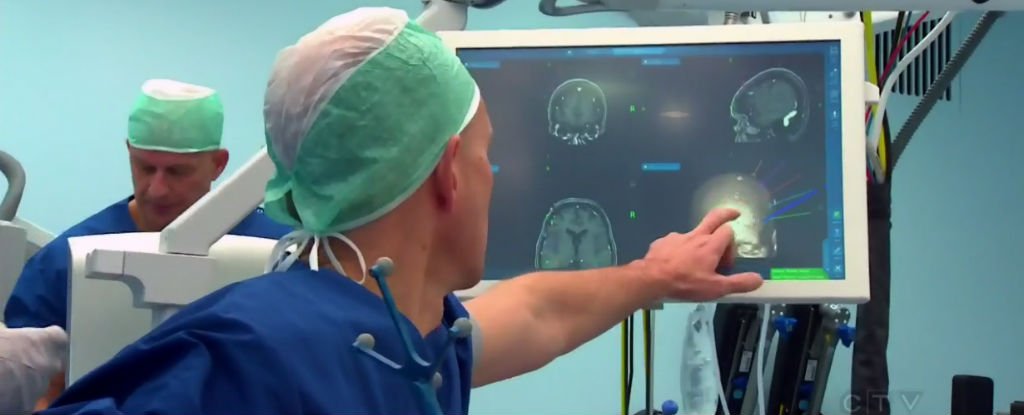 This World-First Brain Implant Is Letting a 'Locked-In' Woman Communicate