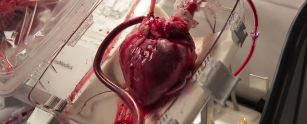 New 'heart-in-a-box' device revives dead hearts for transplant