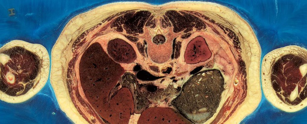 Dead woman sliced 5,000 times creates 'virtual human' for science