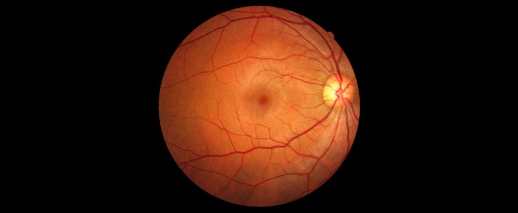 retina-eye_1024.jpg