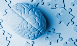 mphillips007_-_brain
