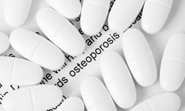 skhoward_-_osteoporosis