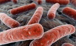 Eraxion_-_E._coli