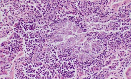 pulmonary_pathology_flickr_-_candida