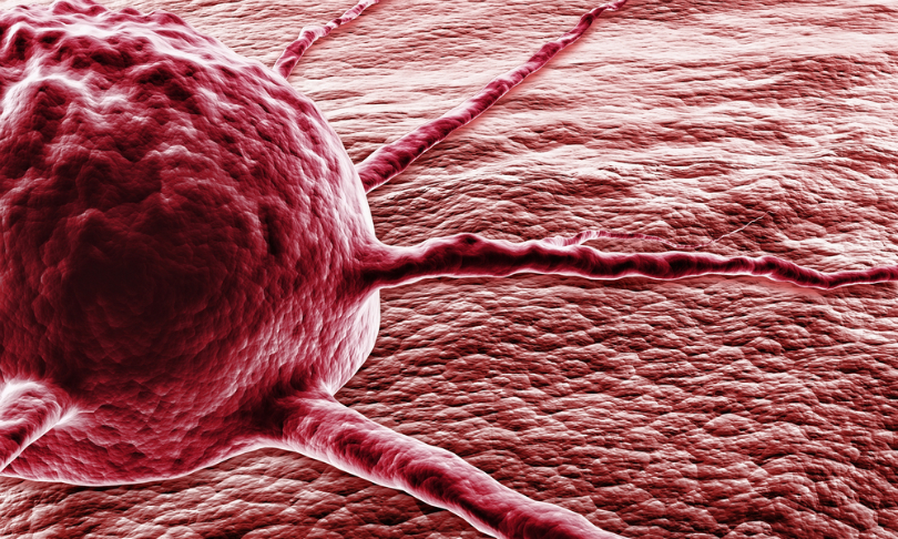 BioMedical_cancercells_shutterstock