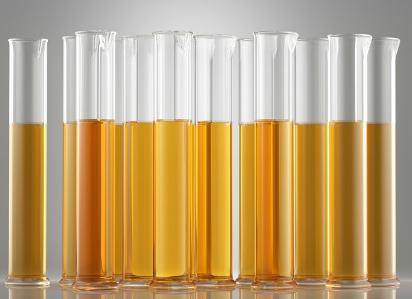 Kasza_urine_shutterstock
