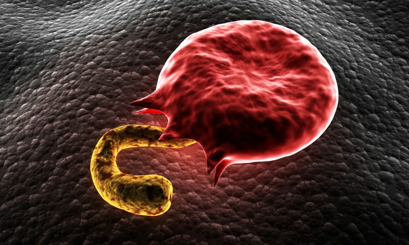 RAJCREATIONZS_malaria_shutterstock