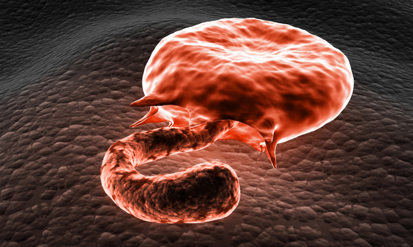 RAJ_CREATIONZS_Malaria_shutterstock