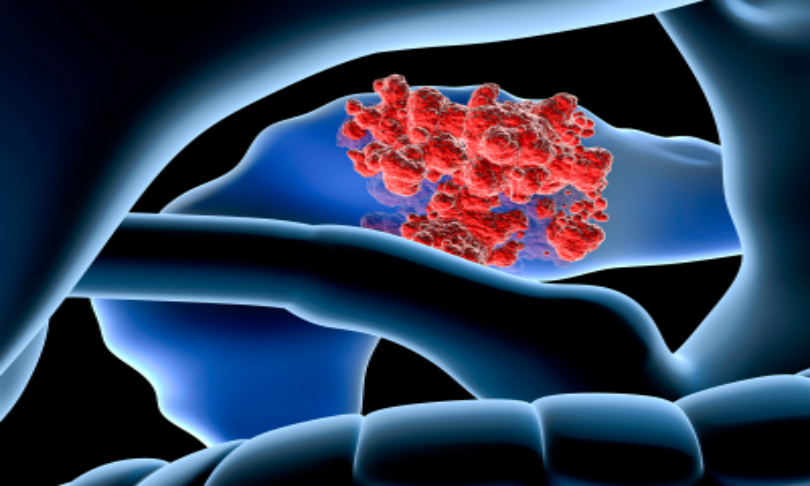 Raycat_pancreas_iStock