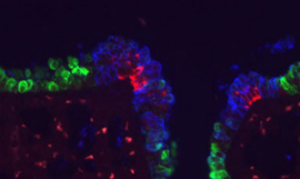 Riken_LungEpithelium