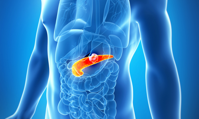 Sebastian_Kaulitzki_PancreaticCancer_shutterstock