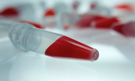 annedde_BloodTest_iStock