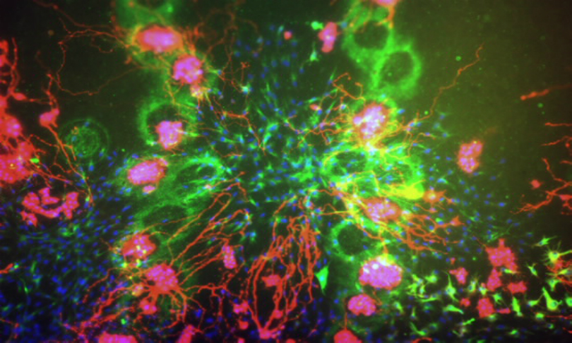 bio-ink_university_of_wollongong