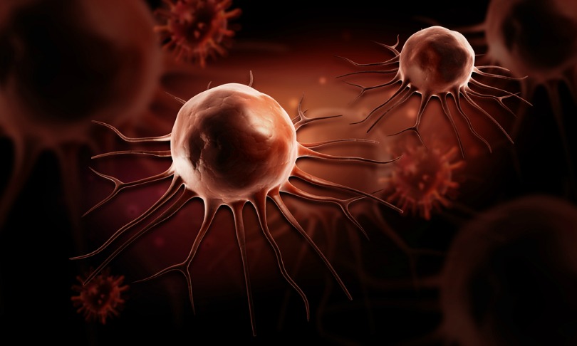 dream-designs_cancer_shutterstock