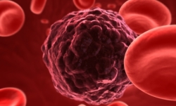 istock_cancer.jpg istock_cancer.jpg