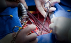 istock_heartsurgery.jpg istock_heartsurgery.jpg