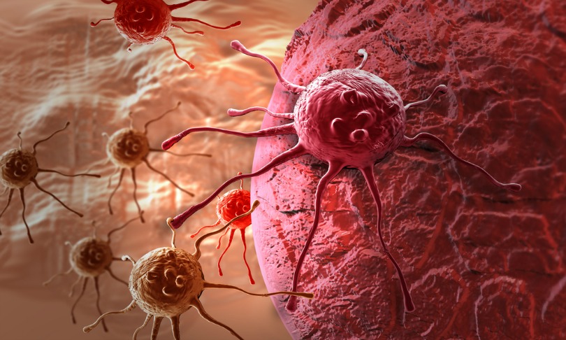jovanvitanovski_cancer_shutterstock