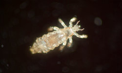 louse.jpg louse.jpg