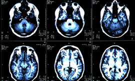 maciu17-MRI-iStock