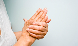 michellegibson_Arthritis_iStock