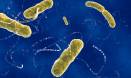 Link between gut and brain suggests therapies for autism