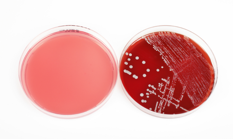 pearls_Bacteria_shutterstock