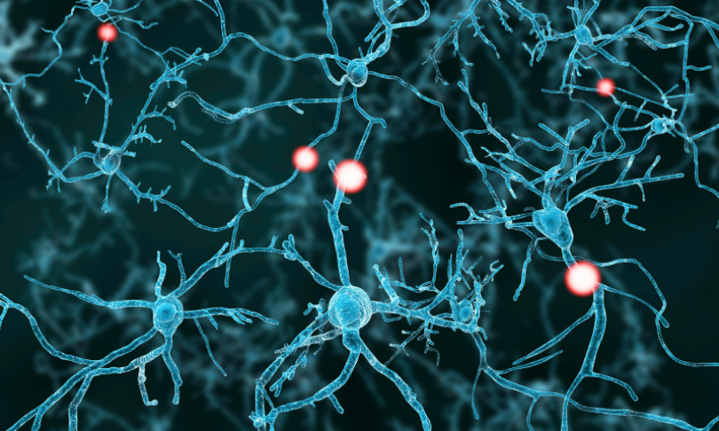 selvanegra_neurons_iStock