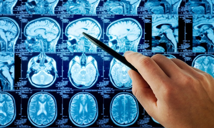 triff_brain_shutterstock