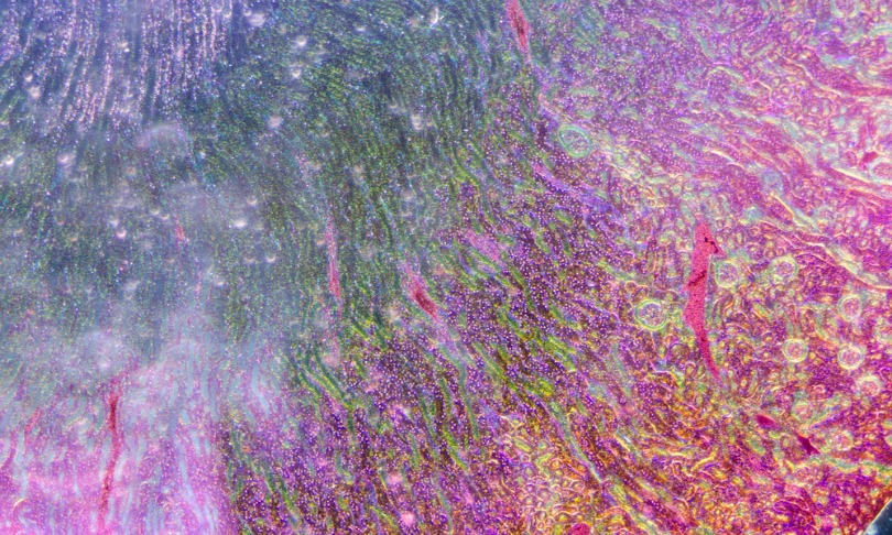 xunbin_kidneycells_shutterstock