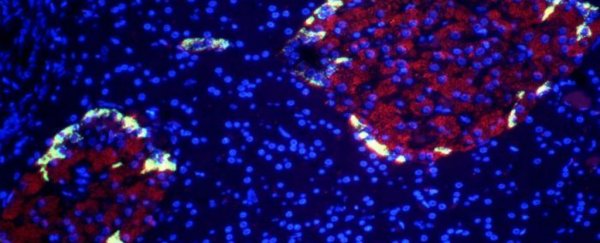 Lab-grown human beta cells have blocked diabetes in mice for good