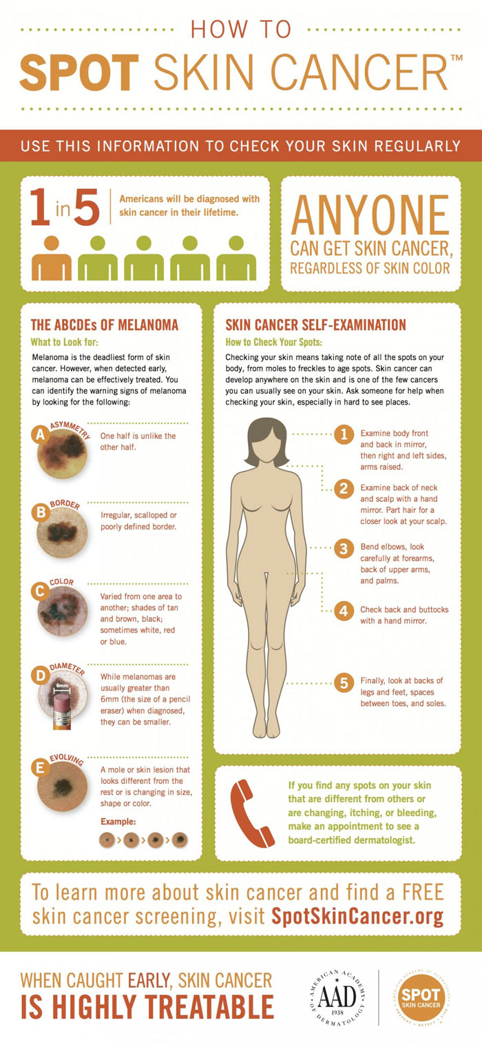 28746283746-BI-melanoma