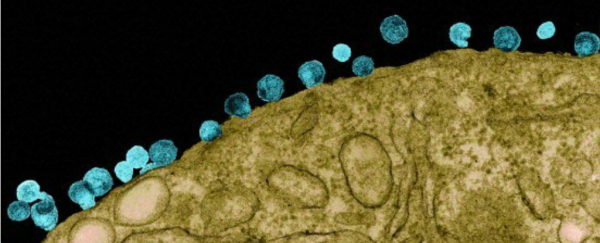 This is the spot where HIV began