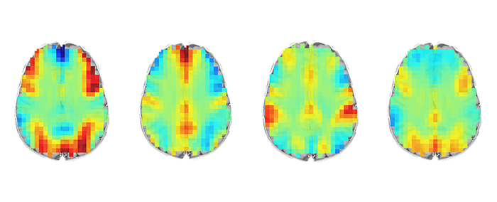 neuro-scans