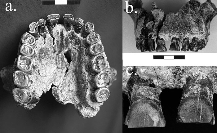 80263420-teeth-2