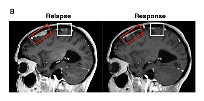 malaria-cancer-treatment