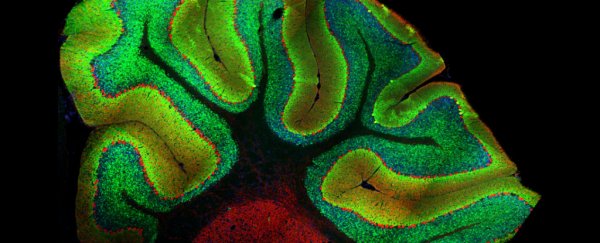 Neuroscientists accidentally discovered a whole new role for the cerebellum