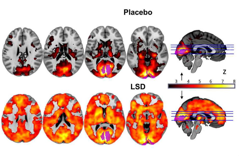 Znalezione obrazy dla zapytania brain on microdosing