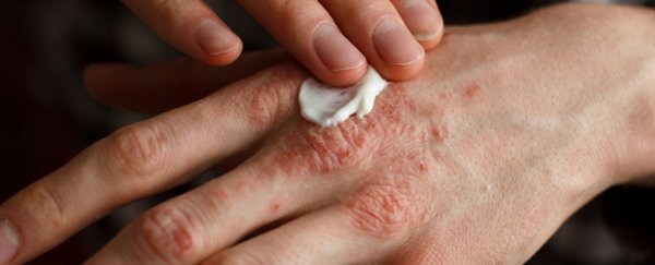 Scientists are figuring out what happens in the skin when you have eczema