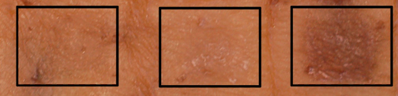 skin compare