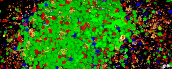 We might have finally found the trigger for autoimmune diseases