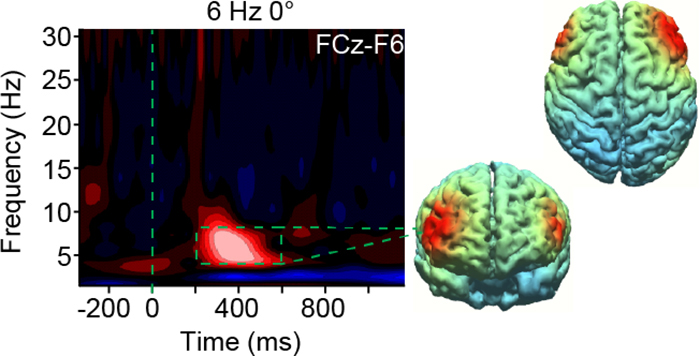 aa brain scan 2