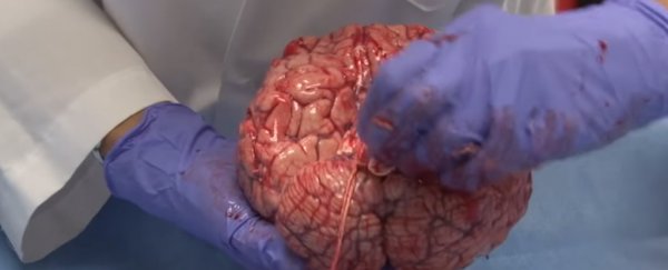 This medical video of a freshly removed human brain is strangely captivating
